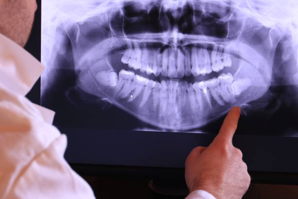 Best Teeth Whitening  in Three Oaks, MI
